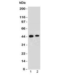 Western Blot: EMI1 Antibody (FBXP5) [NBP3-27923] - Western blot testing of human 1) HeLa and 2) 293 lysate with EMI1 antibody. Predicted molecular weight: 50/45 kDa (isoforms 1/2).