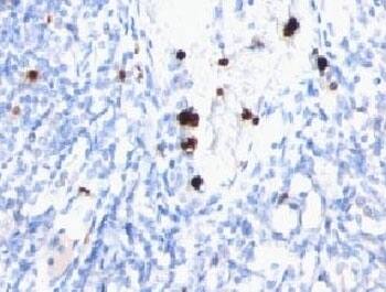 Immunohistochemistry: Myeloid-Associated Differentiation Marker Antibody (MYUP1) [NBP3-27929] - IHC testing of FFPE human tonsil with MYDAM antibody (clone MYUP1).