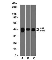 Western Blot: TIA1 Antibody (TRIA1-1) [NBP3-27932] - Western blot testing of A) HepG2, B) PC3 and C) HeLa cell lysate wiht TIA1 antibody (clone TRIA1-1). The long and short forms differ by 17 amino acids. Predicted molecular weight: ~43kDa and ~15kDa (granulocyte-associated isoform).