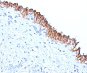 Immunohistochemistry MAML2 Antibody (MMLP2-1)