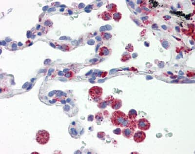 Immunohistochemistry: IRF7 Antibody (3D9) [NBP3-27934] - Human lung tissue stained with IRF7 Antibody at 20 u/mL followed by biotinylated anti-mouse IgG secondary antibody, alkaline phosphatase-streptavidin and chromogen.