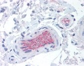 Immunohistochemistry: Complement Factor I Antibody (OX-21) [NBP3-27936] - Immunohistochemistry staining of Complement Factor I in colon, vessels tissue using Complement Factor I monoclonal Antibody.