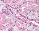 Immunohistochemistry RAD54L Antibody (60.1) - Azide and BSA Free