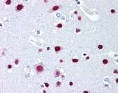 Immunohistochemistry: SAFB Antibody (6F7) [NBP3-27940] - Immunohistochemistry staining of SAFB in brain cortex tissue using SAFB monoclonal Antibody.