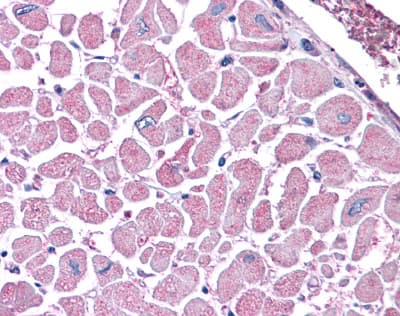 Immunohistochemistry: Kinesin 5B Antibody (KN-03) [NBP3-27944] - Immunohistochemistry of human heart tissue stained using Kinesin 5B Monoclonal Antibody.