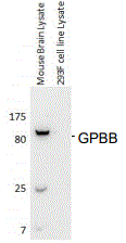 Western Blot: Glycogen Phosphorylase BB/GPBB Antibody (E9B10) [NBP3-27945] - Antibody: Glycogen Phosphorylase BB/GPBB at 1/1000 dilutionSample: 10 ng mouse brain lysate and 35ng HEK 293F lysateSecondary HRP conjugated anti-Rabbit Fc at 1/50000 dilutionPredicted band size: 96 kDaObserved band size: 96 kDaGel concentration: 4-20%