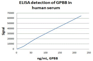 ELISA: Glycogen Phosphorylase BB/GPBB Antibody (E9B10) [NBP3-27945] - Glycogen Phosphorylase BB/GPBB