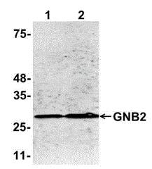 Western Blot: GNB2 Antibody (G4) [NBP3-27949] - Antibody: GNB2 at 1/1000 dilutionSample: Lane: 1 10 ug mouse brain tissue lysate. Lane 2: 30 ug mouse brain tissue lysateSecondary: HRP-conjugated anti-rabbit IgG at 1/50000 dilutionPredicted band size: 37 kDaObserved band size: 29 kDaGel concentration: 4-20%