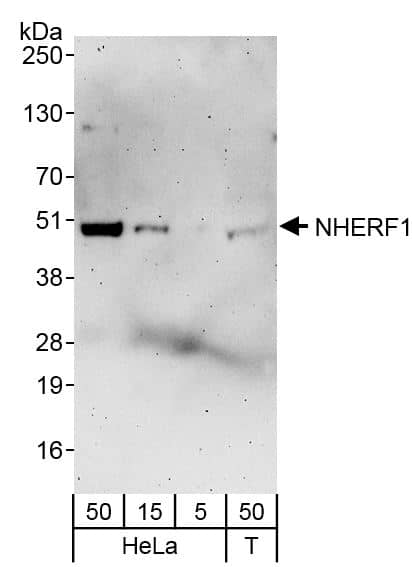 Western Blot:[NBP3-28889]-NHERF-1 Antibody