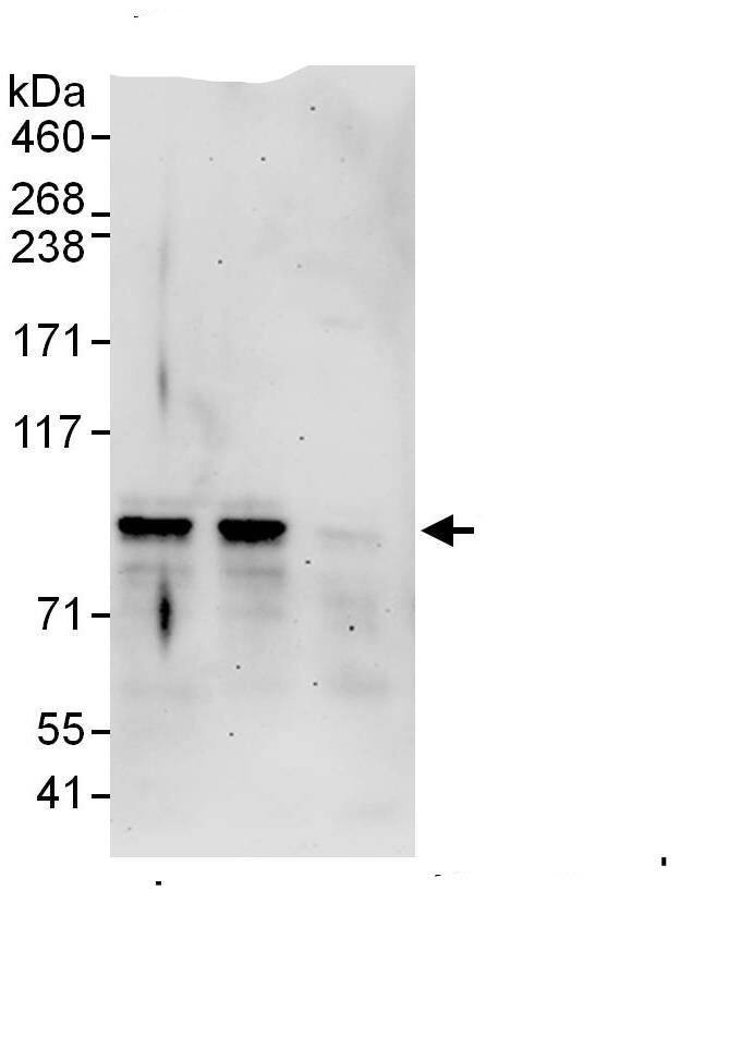 Immunoprecipitation:Nexilin AntibodyNBP3-28891] -Detection of human Nexillin by western blot of immunoprecipitates. Samples: Whole cell lysate (1 mg for IP, 20% of IP loaded) from HEK293T cells. Antibodies: Affinity purified rabbit anti-Nexillin antibody NBP3-28891 used for IP at 6 µg/mg lysate. Nexillin was also immunoprecipitated by rabbit anti-Nexillin antibody , which recognizes a downstream epitope. For blotting immunoprecipitated Nexillin, rabbit anti-Nexillin antibody  was used at 1 µg/ml. Detection: Chemiluminescence with an exposure time of 3 minutes.