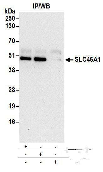 Immunoprecipitation:[NBP3-28894]-Detection of human SLC46A1 by western blot of immunoprecipitates. Samples: Whole cell lysate prepared using NETN buffer from HeLa cells. Antibodies: Affinity purified rabbit anti-SLC46A1 antibody used for IP at 6 µg per reaction. SLC46A1 was also immunoprecipitated by rabbit anti-SLC46A1 antibody. For blotting immunoprecipitated SLC46A1, was used at 0. 1 µg/ml. Detection: Chemiluminescence with an exposure time of 30 seconds.