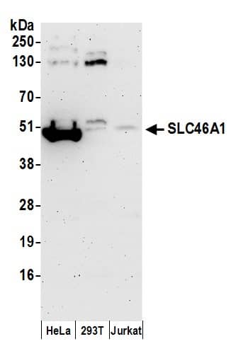 Western Blot:[NBP3-28894]-HCP1 Antibody