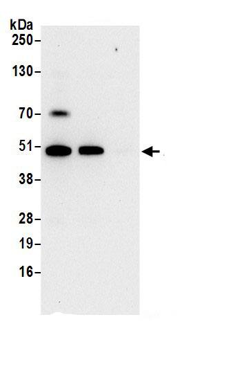 Immunoprecipitation:HADHB AntibodyNBP3-28895] -Detection of human HADHB by western blot of immunoprecipitates. Samples: Whole cell lysate (0.5 or 1.0 mg per IP reaction; 20% of IP loaded) from 293T cells prepared using NETN lysis buffer. Antibodies: Affinity purified rabbit anti-HADHB antibody NBP3-28895 (lot NBP3-28895-1) used for IP at 6 µg per reaction. HADHB was also immunoprecipitated by rabbit anti-HADHB antibody . For blotting immunoprecipitated HADHB, NBP3-28895 was used at 0.4 µg/ml. Detection: Chemiluminescence with an exposure time of 10 seconds.