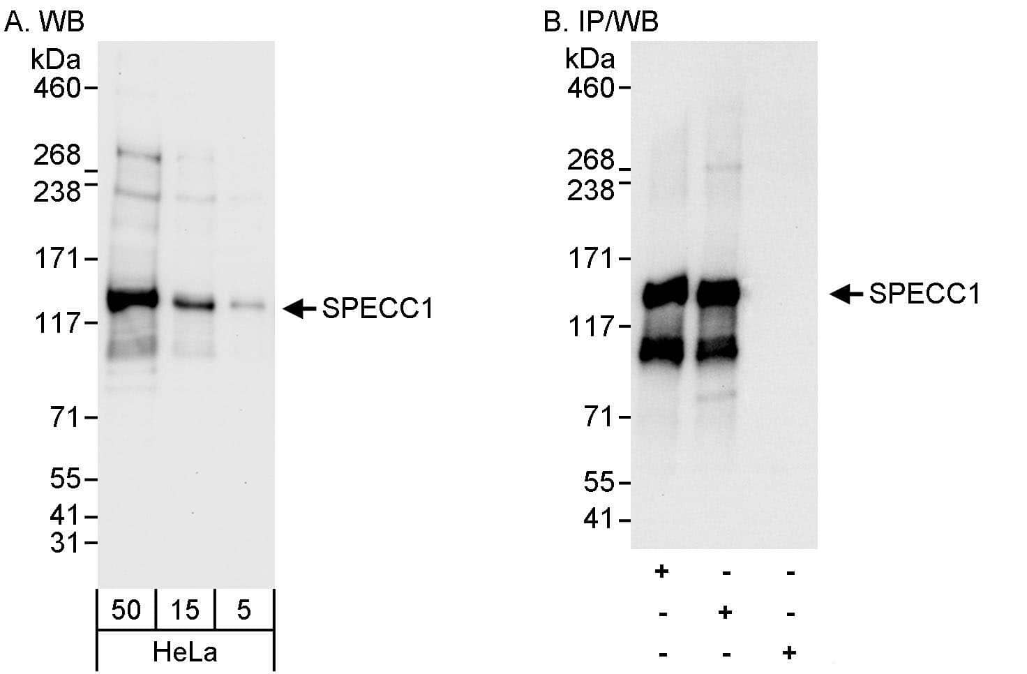 Western Blot:[NBP3-28896]-Detection of human SPECC1 by western blot and immunoprecipitation. Samples: Whole cell lysate from HeLa cells. Antibodies: Affinity purified rabbit anti-SPECC1 antibody used for WB at 0. 04 µg/ml and 0. 4 µg/ml and used for IP at 3 µg/mg lysate. SPECC1 was also immunoprecipitated by rabbit anti-SPECC1 antibody , which recognizes an upstream epitope. Detection: Chemiluminescence with exposure times of 30 seconds and 10 seconds.