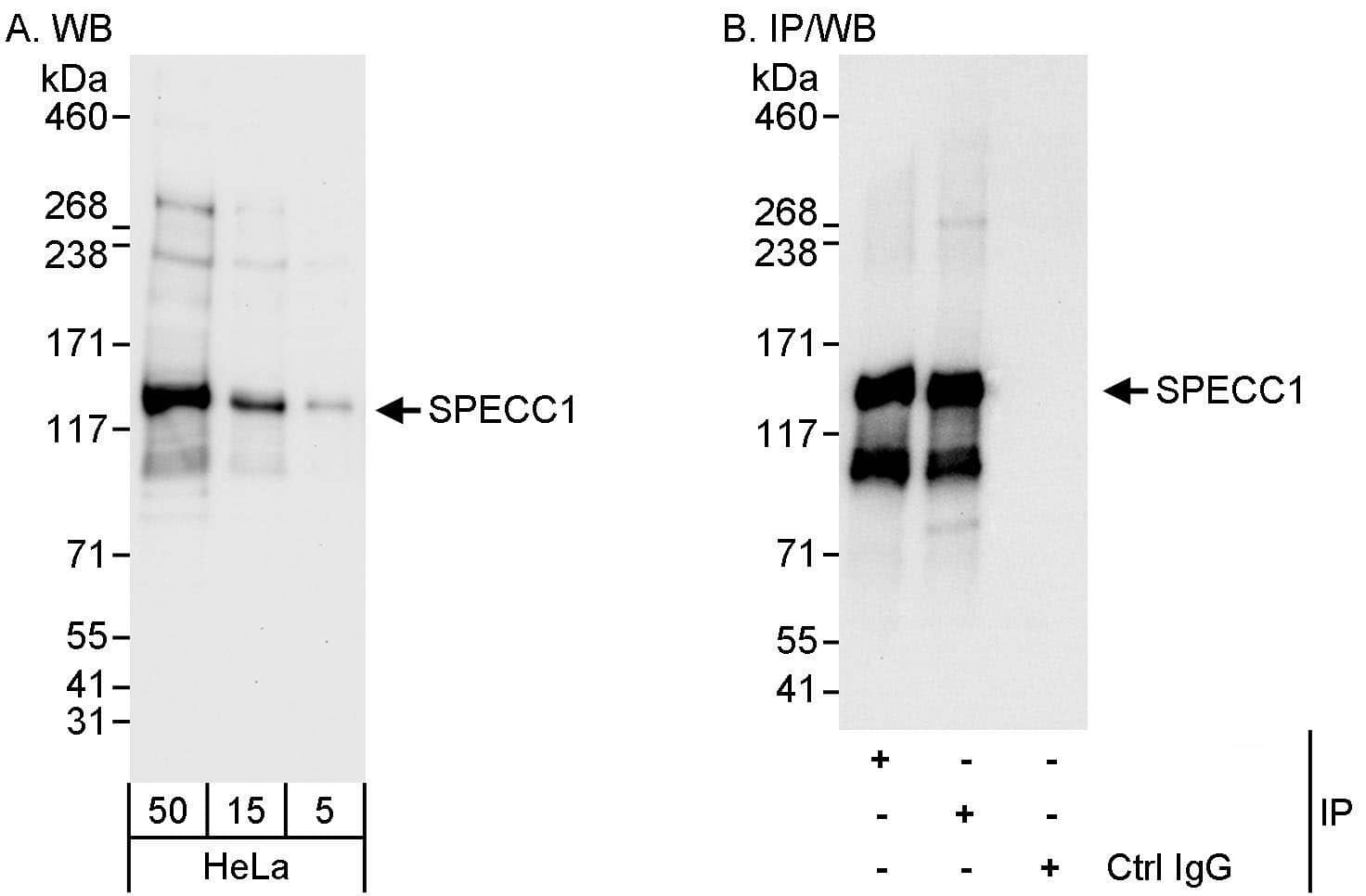 Western Blot:[NBP3-28896]-NSP 5 alpha 3 alpha Antibody