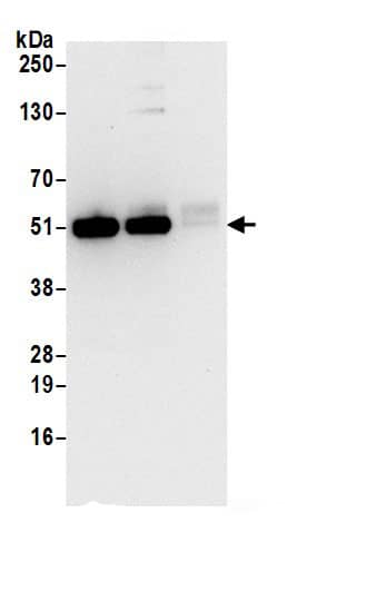 Immunoprecipitation:HADHB AntibodyNBP3-28899] -Detection of human HADHB by western blot of immunoprecipitates. Samples: Whole cell lysate (0.5 or 1.0 mg per IP reaction; 20% of IP loaded) from 293T cells prepared using NETN lysis buffer. Antibodies: Affinity purified rabbit anti-HADHB antibody NBP3-28899 (lot NBP3-28899-1) used for IP at 6 µg per reaction. HADHB was also immunoprecipitated by rabbit anti-HADHB antibody. For blotting immunoprecipitated HADHB, NBP3-28899 was used at 0.4 µg/ml. Detection: Chemiluminescence with an exposure time of 10 seconds.