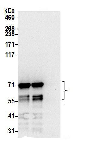 Immunoprecipitation:SRPR alpha AntibodyNBP3-28900] -Detection of human SRPRA by western blot of immunoprecipitates. Samples: Whole cell lysate (0.5 or 1.0 mg per IP reaction; 20% of IP loaded) from 293T and cells prepared using NETN lysis buffer. Antibodies: Affinity purified rabbit anti-SRPRA antibody NBP3-28900 (lot NBP3-28900-1) used for IP at 6 µg per reaction. SRPRA was also immunoprecipitated by rabbit anti-SRPRA antibody . For blotting immunoprecipitated SRPRA, NBP3-28900 was used at 0.4 µg/ml. Detection: Chemiluminescence with an exposure time of 10 seconds.