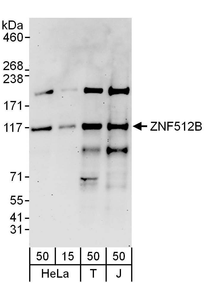 Western Blot:[NBP3-28902]-Detection of human ZNF512B by western blot. Samples: Whole cell lysate from HeLa , HEK293T and Jurkat cells. Antibodies: Affinity purified rabbit anti-ZNF512B antibody used for WB at 0. 1 µg/ml. Detection: Chemiluminescence with an exposure time of 3 minutes.