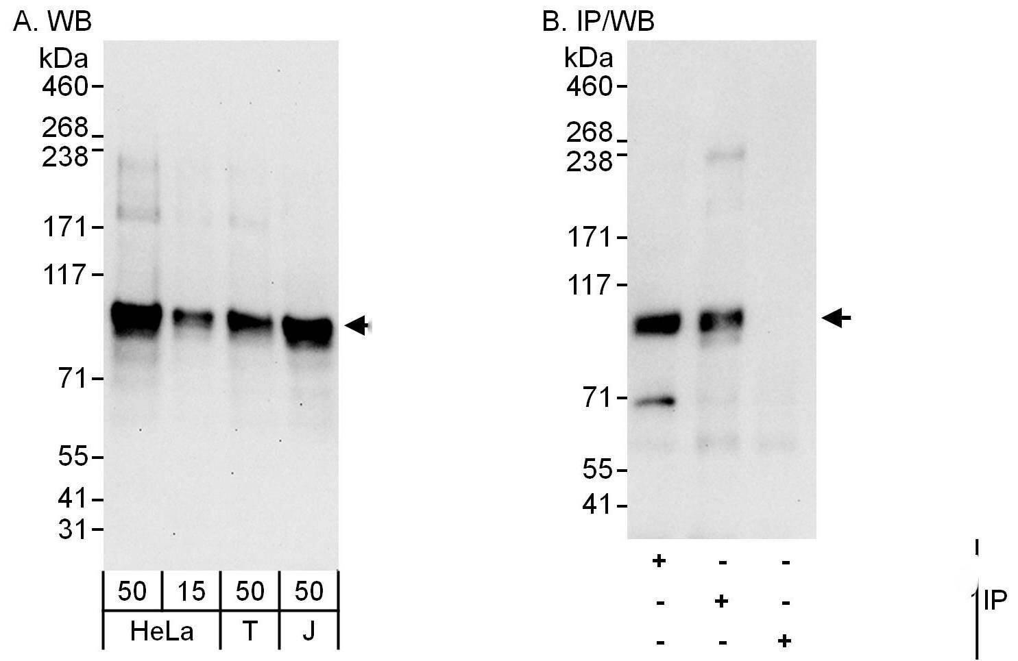 Western Blot:[NBP3-28906]-Detection of human DYRK1A by western blot and immunoprecipitation. Samples: Whole cell lysate from HeLa , HEK293T and Jurkat cells. Antibodies: Affinity purified rabbit antibody used for WB at 0. 1 µg/ml and 1 µg/ml and used for IP at 6 µg/mg lysate. DYRK1A was also immunoprecipitated by rabbit antibody , which recognizes an upstream epitope. Detection: Chemiluminescence with exposure times of 30 seconds and 10 seconds.