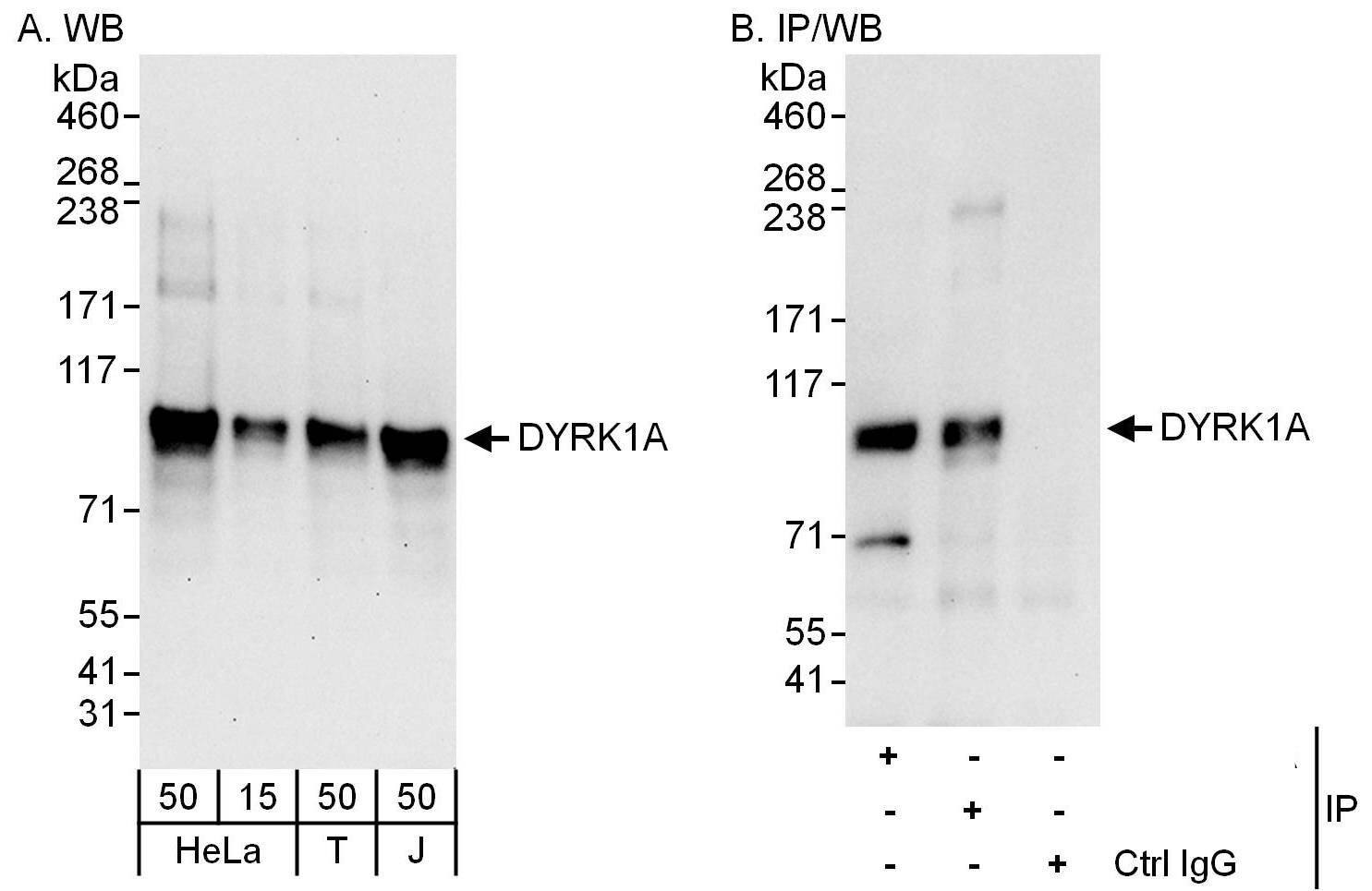 Western Blot:[NBP3-28906]-DYRK1A Antibody
