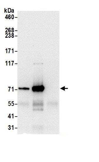 Immunoprecipitation:HADHA AntibodyNBP3-28907] -Detection of human HADHA by western blot of immunoprecipitates. Samples: Whole cell lysate (0.5 or 1.0 mg per IP reaction; 20% of IP loaded) from 293T cells prepared using NETN lysis buffer. Antibodies: Affinity purified rabbit anti-HADHA antibody NBP3-28907 (lot NBP3-28907-1) used for IP at 6 µg per reaction. HADHA was also immunoprecipitated by rabbit anti-HADHA antibody. For blotting immunoprecipitated HADHA, NBP3-28907 was used at 0.4 µg/ml. Detection: Chemiluminescence with an exposure time of 10 seconds.