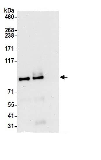 Immunoprecipitation:COG7 AntibodyNBP3-28910] -Detection of human COG7 by western blot of immunoprecipitates. Samples: Whole cell lysate (0.5 or 1.0 mg per IP reaction; 20% of IP loaded) from HeLa cells prepared using NETN lysis buffer. Antibodies: Affinity purified rabbit anti-COG7 antibody NBP3-28910 (lot NBP3-28910-1) used for IP at 6 µg per reaction. COG7 was also immunoprecipitated by rabbit anti-COG7 antibody . For blotting immunoprecipitated COG7, NBP3-28910 was used at 1 µg/ml. Detection: Chemiluminescence with an exposure time of 30 seconds.