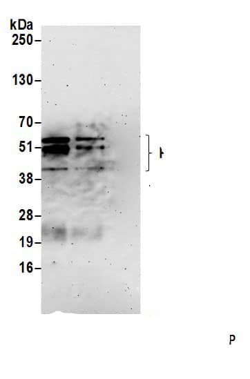 Immunoprecipitation:PRRC1 AntibodyNBP3-28912] -Detection of human PRRC1 by western blot of immunoprecipitates. Samples: Whole cell lysate (1.0 mg per IP reaction; 20% of IP loaded) from HeLa cells prepared using NETN lysis buffer. Antibodies: Affinity purified rabbit anti-PRRC1 antibody (NBP3-28912 lot 1) used for IP at 2 µg per reaction. PRRC1 was also immunoprecipitated by rabbit anti-PRRC1 antibody. For blotting immunoprecipitated PRRC1, NBP3-28912 was used at 0.1 mg/ml. Detection: Chemiluminescence with an exposure time of 3 minutes.