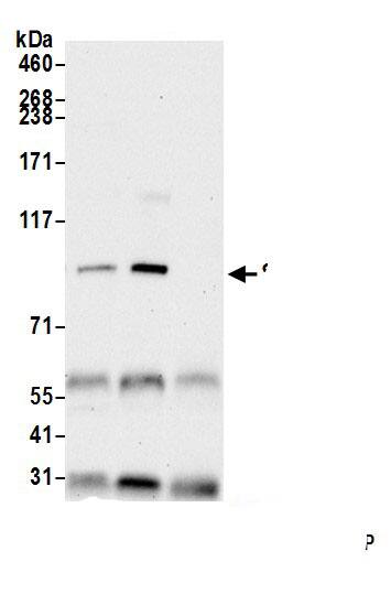 Immunoprecipitation:SARDH AntibodyNBP3-28913] -Detection of human SARDH by western blot of immunoprecipitates. Samples: Whole cell lysate (1.0 mg per IP reaction; 20% of IP loaded) from Hep-G2 cells prepared using NETN lysis buffer. Antibodies: Affinity purified rabbit anti-SARDH antibody (NBP3-28913 lot 1) used for IP at 1 µg per reaction. SARDH was also immunoprecipitated by rabbit anti-SARDH antibody. For blotting immunoprecipitated SARDH, NBP3-28913 was used at 0.04 mg/ml. Detection: Chemiluminescence with an exposure time of 30 seconds.
