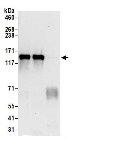 Immunoprecipitation DNA helicase B Antibody - BSA Free