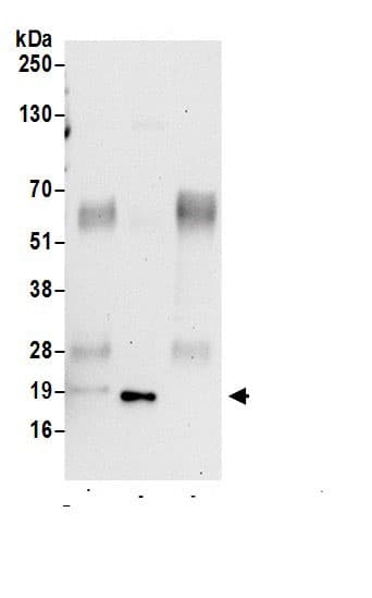 Immunoprecipitation KIAA1143 Antibody - BSA Free