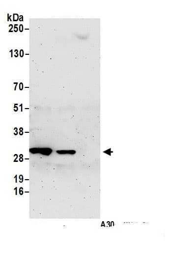 Immunoprecipitation:NIT2 AntibodyNBP3-28918] -Detection of human NIT2 by western blot of immunoprecipitates. Samples: Whole cell lysate (1.0 mg per IP reaction; 20% of IP loaded) from 293T cells prepared using NETN lysis buffer. Antibodies: Affinity purified rabbit anti-NIT2 antibody (NBP3-28918 lot 1) used for IP at 2 µg per reaction. NIT2 was also immunoprecipitated by rabbit anti-NIT2 antibody . For blotting immunoprecipitated NIT2, NBP3-28918 was used at 0.1 mg/ml. Detection: Chemiluminescence with an exposure time of 3 minutes.