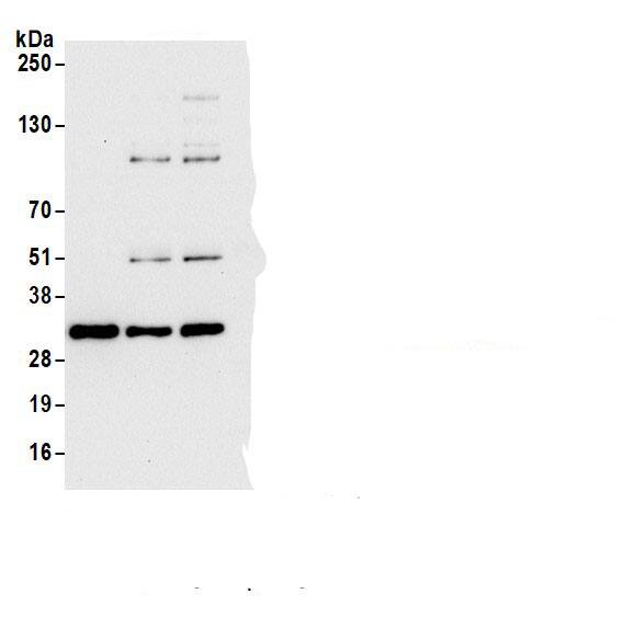 Immunoprecipitation:CBR1 AntibodyNBP3-28919] -Detection of human Carbonyl Reductase 1/CBR1 by western blot of immunoprecipitates. Samples: Whole cell lysate (1.0 mg per IP reaction; 20% of IP loaded) from HEK293T cells prepared using NETN lysis buffer. Antibodies: Affinity purified rabbit anti-Carbonyl Reductase 1/CBR1 antibody NBP3-28919 Lot 2 used for IP at 6 µg per reaction. Carbonyl Reductase 1/CBR1 was also immunoprecipitated by a previous lot of this antibody (NBP3-28919 Lot 1) and rabbit anti-Carbonyl Reductase 1/CBR1 antibody. For blotting immunoprecipitated Carbonyl Reductase 1/CBR1, NBP3-28919 was used at 0.04 µg/ml. Detection: Chemiluminescence with an exposure time of 10 seconds.