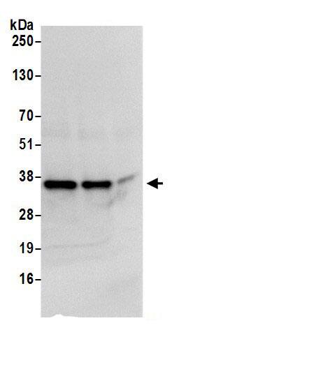 Immunoprecipitation:CBR1 AntibodyNBP3-28920] -Detection of human Carbonyl Reductase 1/CBR1 by western blot of immunoprecipitates. Samples: Whole cell lysate (0.5 or 1.0 mg per IP reaction; 20% of IP loaded) from HeLa cells prepared using NETN lysis buffer. Antibody: Affinity purified rabbit anti-Carbonyl Reductase 1/CBR1 antibody NBP3-28920 (lot NBP3-28920-1) used for IP at 6 µg per reaction. Carbonyl Reductase 1/CBR1 was also immunoprecipitated by rabbit anti-Carbonyl Reductase 1/CBR1 antibody . For blotting immunoprecipitated Carbonyl Reductase 1/CBR1, NBP3-28920 was used at 1 µg/ml. Detection: Chemiluminescence with an exposure time of 1 second.