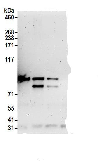 Immunoprecipitation:TOX4 AntibodyNBP3-28921] -Detection of human TOX4 by western blot of immunoprecipitates. Samples: Whole cell lysate (0.5 or 1.0 mg per IP reaction; 20% of IP loaded) from 293T cells prepared using NETN lysis buffer. Antibodies: Affinity purified rabbit anti-TOX4 antibody NBP3-28921 (lot NBP3-28921-1) used for IP at 6 µg per reaction. TOX4 was also immunoprecipitated by rabbit anti-TOX4 antibodies. For blotting immunoprecipitated TOX4, NBP3-28921 was used at 1 µg/ml. Detection: Chemiluminescence with an exposure time of 3 minutes.