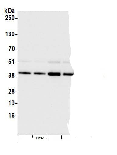 Immunoprecipitation:ISY1 AntibodyNBP3-28922] -Detection of human ISY1 by western blot of immunoprecipitates. Samples: Whole cell lysate (0.5 or 1.0 mg per IP reaction; 20% of IP loaded) from 293T cells prepared using NETN lysis buffer. Antibodies: Affinity purified rabbit anti-ISY1 antibody NBP3-28922 (lot NBP3-28922-1) used for IP at 6 µg per reaction. ISY1 was also immunoprecipitated by rabbit anti-ISY1 antibody. For blotting immunoprecipitated ISY1, NBP3-28922 was used at 0.4 µg/ml. Detection: Chemiluminescence with an exposure time of 30 seconds.