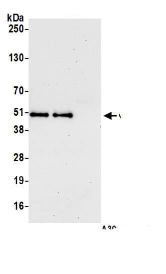 Immunoprecipitation:Calumenin AntibodyNBP3-28923] -Detection of human CALU by western blot of immunoprecipitates. Samples: Whole cell lysate (0.5 or 1.0 mg per IP reaction; 20% of IP loaded) from 293T cells prepared using NETN lysis buffer. Antibodies: Affinity purified rabbit anti-CALU antibody NBP3-28923 (lot NBP3-28923-1) used for IP at 6 µg per reaction. CALU was also immunoprecipitated by rabbit anti-CALU antibody . For blotting immunoprecipitated CALU, NBP3-28923 was used at 1 µg/ml. Detection: Chemiluminescence with an exposure time of 30 seconds.