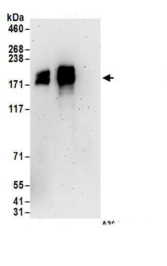 Immunoprecipitation:CRAMP1L AntibodyNBP3-28925] -Detection of human CRAMP1L by western blot of immunoprecipitates. Samples: Whole cell lysate (1 mg for IP; 20% of IP loaded) from Jurkat cells. Antibodies: Affinity purified rabbit anti-CRAMP1L antibody NBP3-28925 (lot NBP3-28925-1) used for IP at 6 µg/mg lysate. CRAMP1L was also immunoprecipitated by rabbit anti-CRAMP1L antibody. For blotting immunoprecipitated CRAMP1L, NBP3-28925 was used at 0.4 µg/ml. Detection: Chemiluminescence with an exposure time of 3 minutes.