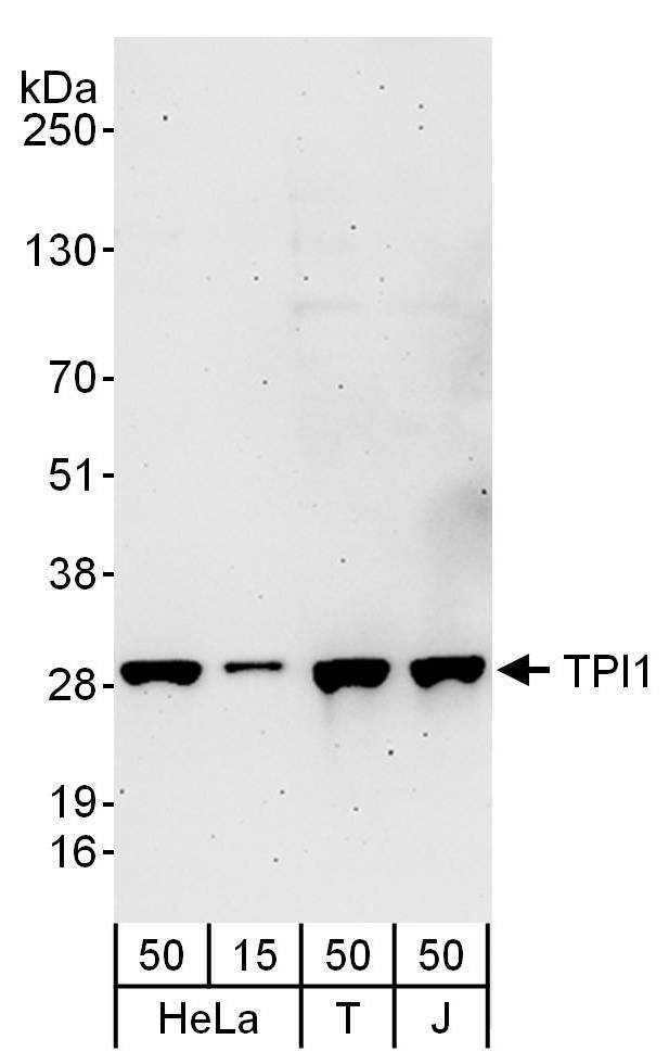 Western Blot:[NBP3-28927]-Detection of human TPI1 by western blot. Samples: Whole cell lysate from HeLa , HEK293T and Jurkat cells. Antibodies: Affinity purified rabbit anti-TPI1 antibody used for WB at 0. 1 µg/ml. Detection: Chemiluminescence with an exposure time of 3 minutes.