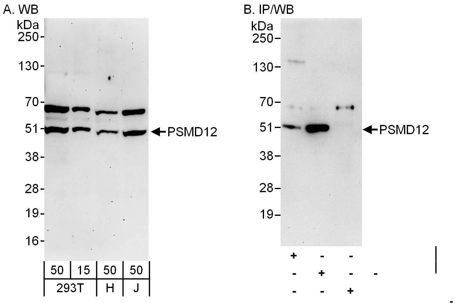 Western Blot PSMD12 Antibody