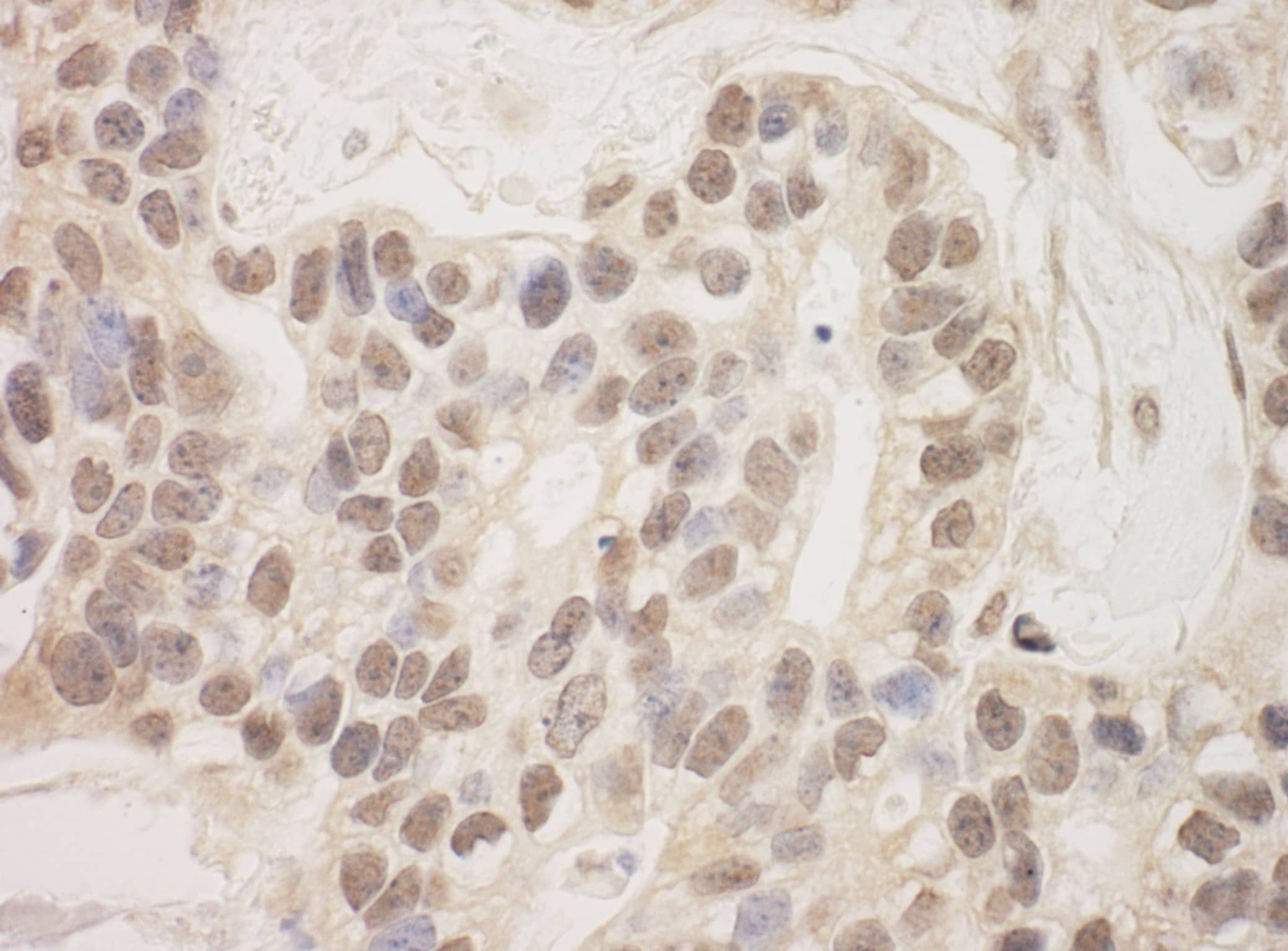 Immunohistochemistry Sin3A-associated protein Antibody