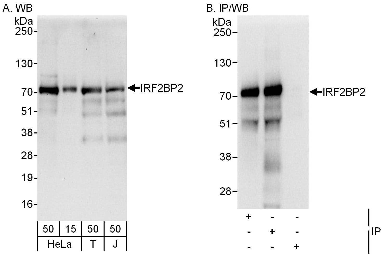 Western Blot:[NBP3-28933]-Detection of human IRF2BP2 by western blot and immunoprecipitation. Samples: Whole cell lysate from HeLa , HEK293T and Jurkat cells. Antibodies: Affinity purified rabbit anti-IRF2BP2 antibody used for WB at 0. 04 µg/ml and 1 µg/ml and used for IP at 6 µg/mg lysate. IRF2BP2 was also immunoprecipitated by rabbit anti-IRF2BP2 antibody , which recognizes an upstream epitope. Detection: Chemiluminescence with exposure times of 30 seconds and 1 second.