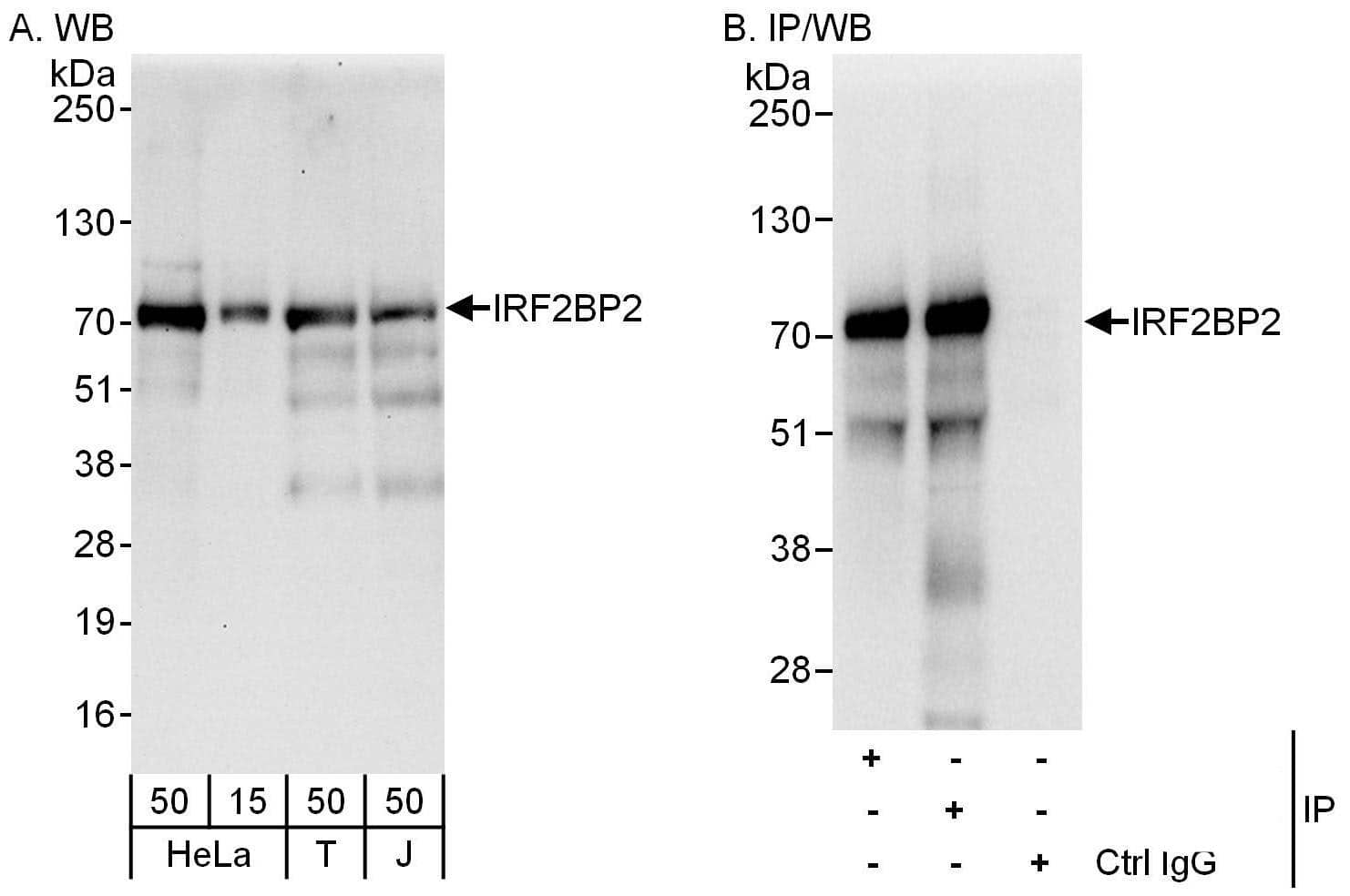 Western Blot:[NBP3-28933]-IRF2BP2 Antibody