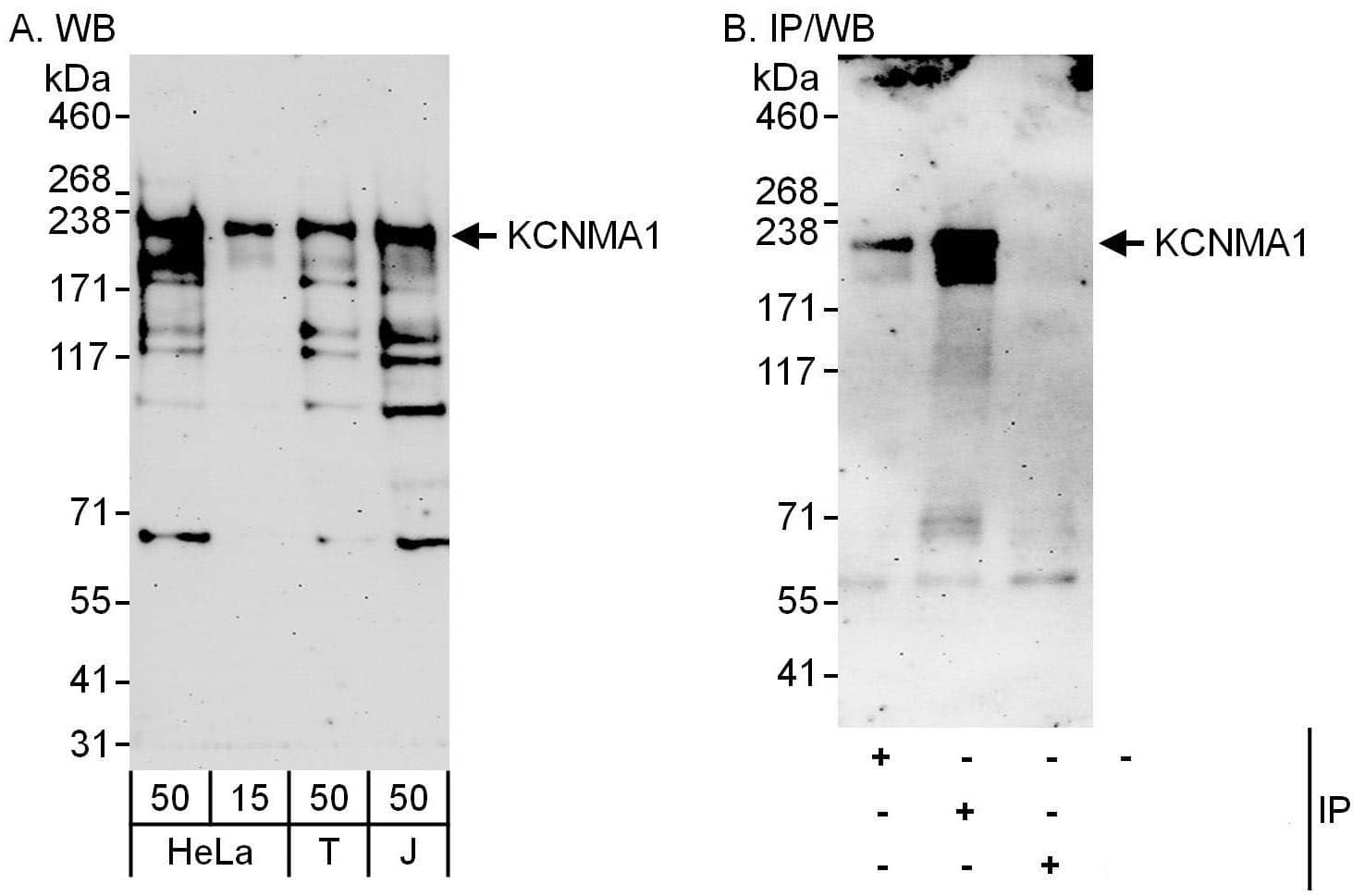 Western Blot:[NBP3-28935]-Detection of human KCNMA1 by western blot and immunoprecipitation. Samples: Whole cell lysate from HeLa , HEK293T and Jurkat cells. Antibodies: Affinity purified rabbit anti-KCNMA1 antibody used for WB at 0. 4 µg/ml and 1 µg/ml and used for IP at 6 µg/mg lysate. KCNMA1 was also immunoprecipitated by rabbit anti-KCNMA1 antibody , which recognizes an upstream epitope. Detection: Chemiluminescence with exposure times of 3 minutes.