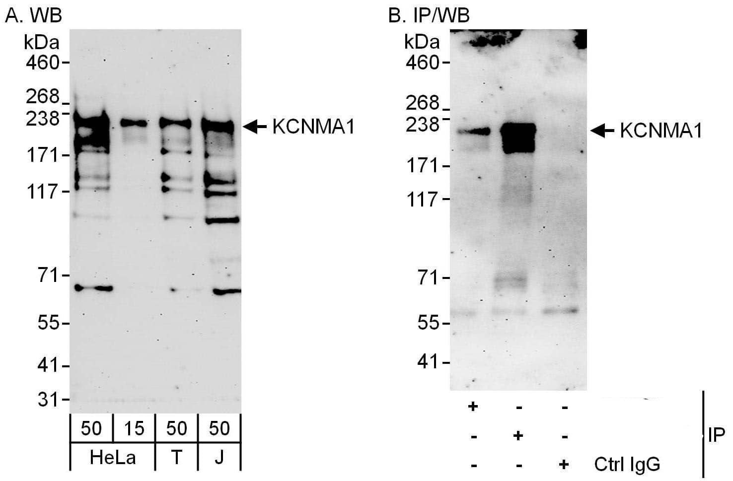 Western Blot:[NBP3-28935]-Maxi Potassium channel alpha Antibody