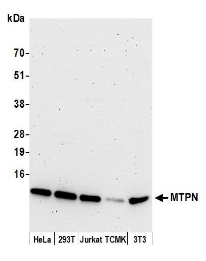Western Blot:[NBP3-28937]-Myotrophin Antibody