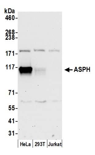 Western Blot:[NBP3-28939]-Aspartate beta hydroxylase Antibody