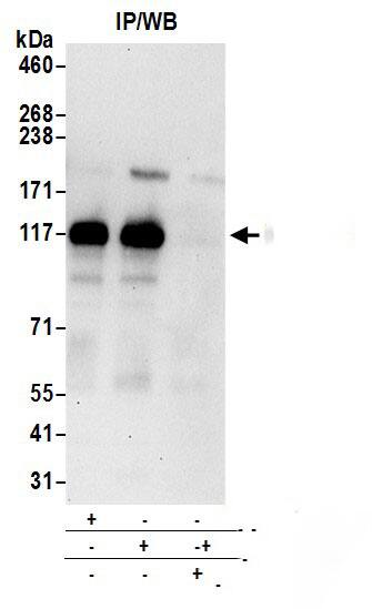 Immunoprecipitation:[NBP3-28943]-Detection of human DCBLD2 by western blot of immunoprecipitates. Samples: Whole cell lysate prepared using NETN buffer from HeLa cells. Antibodies: Affinity purified rabbit anti-DCBLD2 antibody used for IP at 6 µg per reaction. DCBLD2 was also immunoprecipitated by rabbit anti-DCBLD2 antibody. For blotting immunoprecipitated DCBLD2, was used at 1 µg/ml. Detection: Chemiluminescence with an exposure time of 30 seconds.