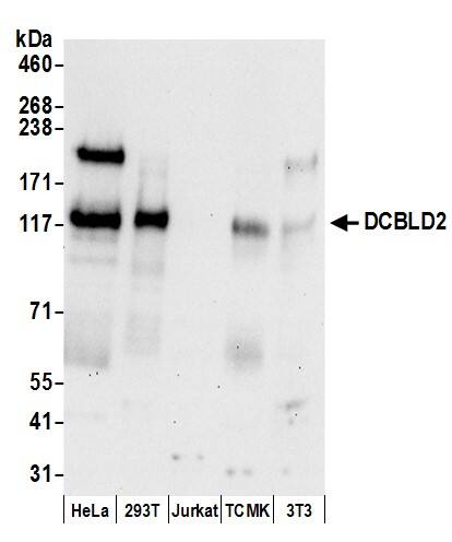 Western Blot:[NBP3-28943]-DCBLD2/ESDN Antibody