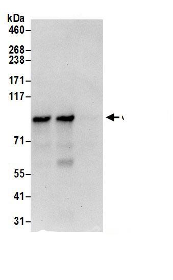 Immunoprecipitation:CNNM4 AntibodyNBP3-28944] -Detection of human Cyclin M4 by western blot of immunoprecipitates. Samples: Whole cell lysate (0.5 or 1.0 mg per IP reaction; 20% of IP loaded) from HeLa cells prepared using RIPA lysis buffer. Antibodies: Affinity purified rabbit anti-Cyclin M4 antibody NBP3-28944 (lot NBP3-28944-1) used for IP at 6 µg per reaction. Cyclin M4 was also immunoprecipitated by rabbit anti-Cyclin M4 antibody. For blotting immunoprecipitated Cyclin M4, NBP3-28944 was used at 1 µg/ml. Detection: Chemiluminescence with an exposure time of 30 seconds.