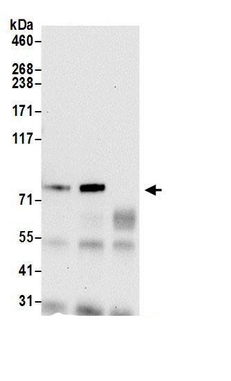 Immunoprecipitation:QARS AntibodyNBP3-28945] -Detection of human QARS by western blot of immunoprecipitates. Samples: Whole cell lysate (0.5 or 1.0 mg per IP reaction; 20% of IP loaded) from 293T cells prepared using NETN lysis buffer. Antibodies: Affinity purified rabbit anti-QARS antibody NBP3-28945 (lot NBP3-28945-1) used for IP at 6 µg per reaction. QARS was also immunoprecipitated by rabbit anti-QARS antibody. For blotting immunoprecipitated QARS, NBP3-28945 was used at 0.4 µg/ml. Detection: Chemiluminescence with an exposure time of 30 seconds.